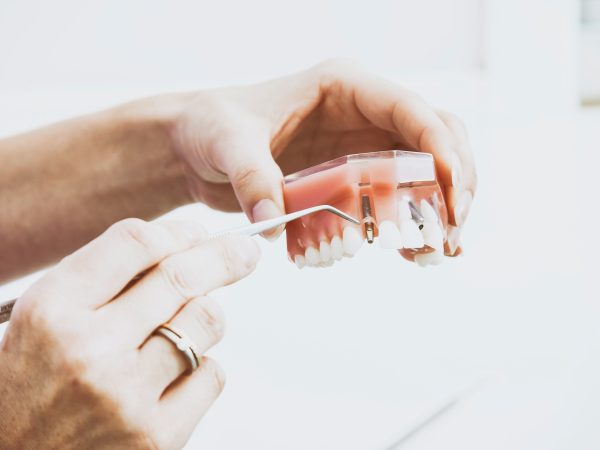 Who Can Benefit Most From Dental Implants Surgery?