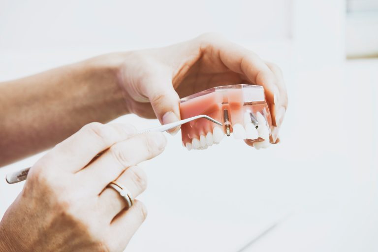 Who Can Benefit Most From Dental Implants Surgery?